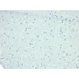 Immunohistochemistry - Anti-CD10 Antibody [MME/6714] - BSA and Azide free (A278301) - Antibodies.com
