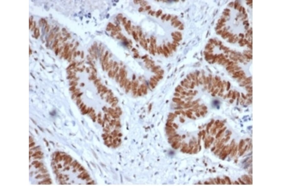 Immunohistochemistry - Anti-MSH2 Antibody [MSH2/6852] - BSA and Azide free (A278305) - Antibodies.com