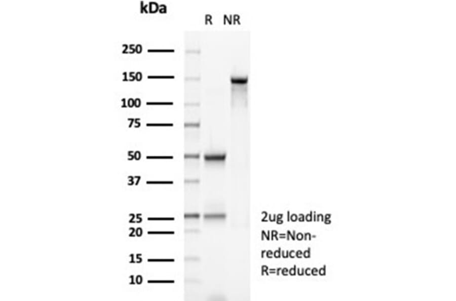 SDS-PAGE - Anti-MSH2 Antibody [MSH2/6852] - BSA and Azide free (A278305) - Antibodies.com