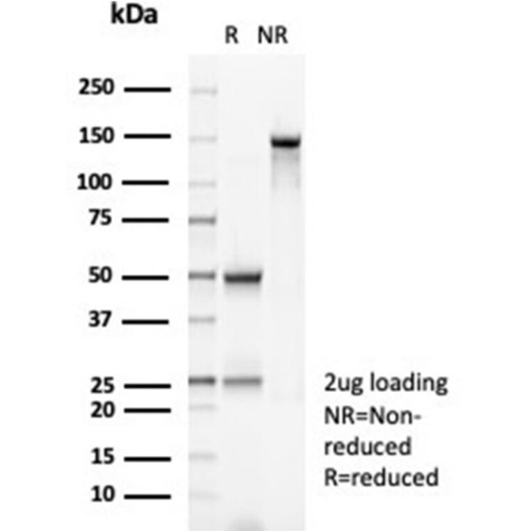 SDS-PAGE - Anti-MSH2 Antibody [MSH2/6852] - BSA and Azide free (A278305) - Antibodies.com