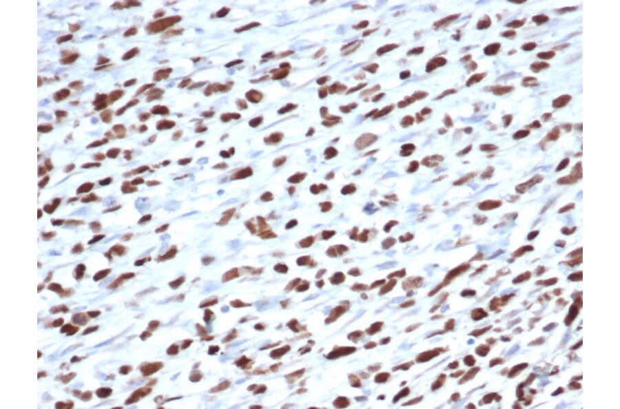 Immunohistochemistry - Anti-MyoD1 Antibody [5.8A] - BSA and Azide free (A278308) - Antibodies.com