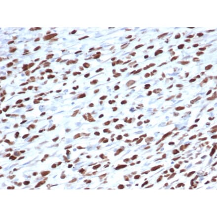 Immunohistochemistry - Anti-MyoD1 Antibody [5.8A] - BSA and Azide free (A278308) - Antibodies.com
