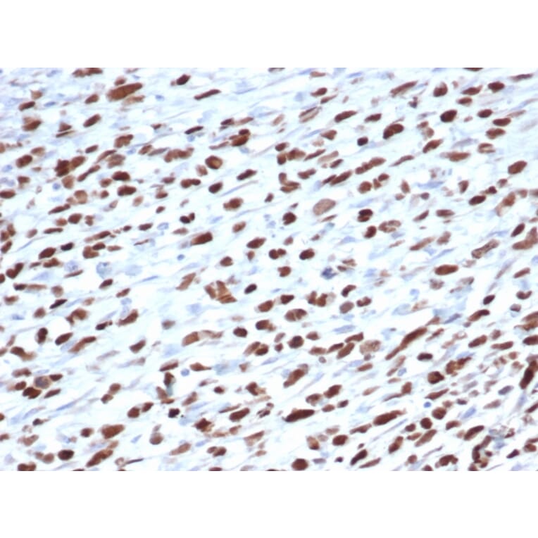 Immunohistochemistry - Anti-MyoD1 Antibody [5.8A] - BSA and Azide free (A278308) - Antibodies.com
