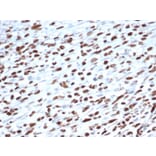 Immunohistochemistry - Anti-MyoD1 Antibody [5.8A] - BSA and Azide free (A278308) - Antibodies.com