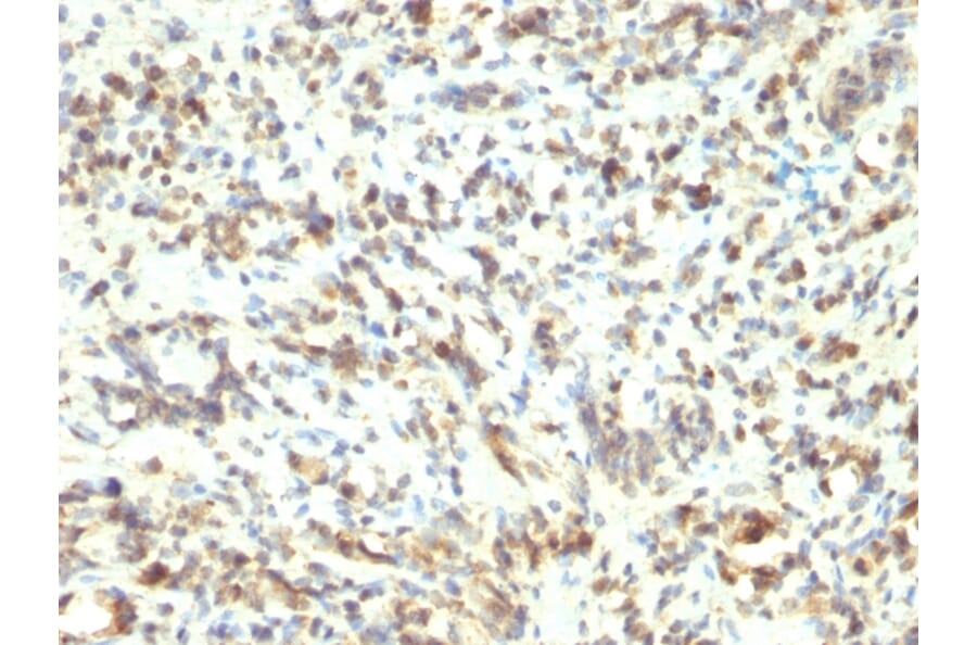 Immunohistochemistry - Anti-MyoD1 Antibody [5.8A] - BSA and Azide free (A278308) - Antibodies.com