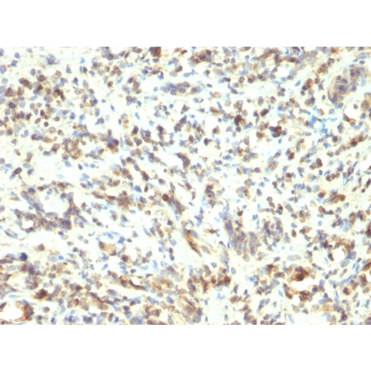 Immunohistochemistry - Anti-MyoD1 Antibody [5.8A] - BSA and Azide free (A278308) - Antibodies.com