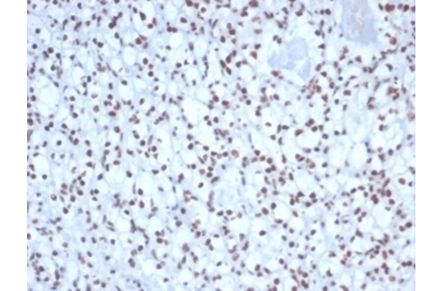Immunohistochemistry - Anti-Nucleolin Antibody [NCL/7338] - BSA and Azide free (A278310) - Antibodies.com