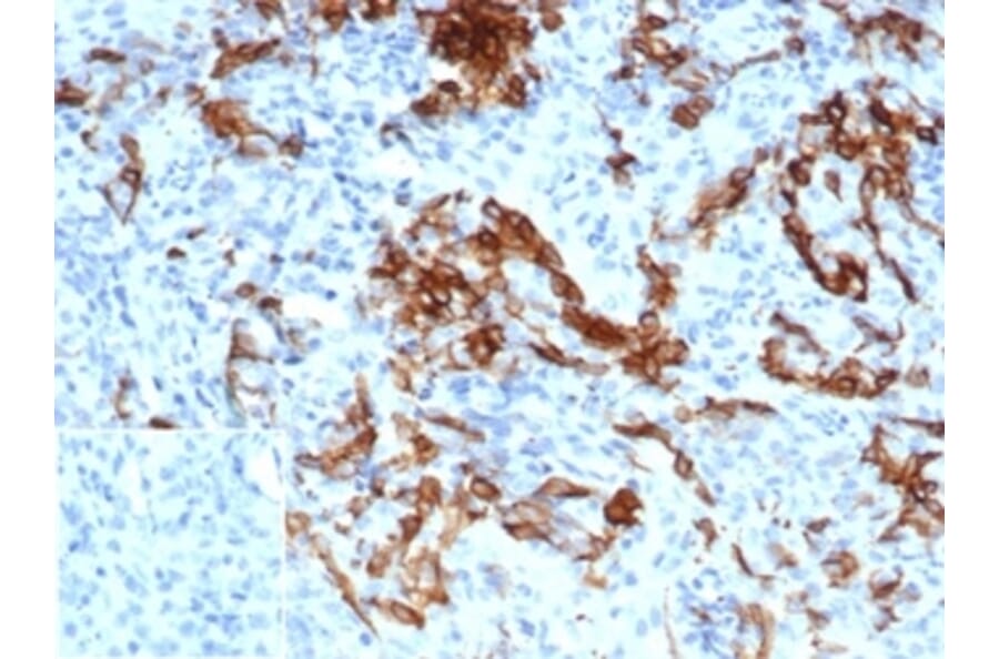 Immunohistochemistry - Anti-p75 NGF Receptor Antibody [NGFR/4919] - BSA and Azide free (A278313) - Antibodies.com