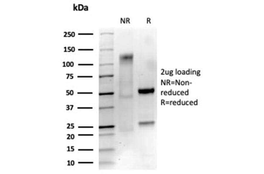 SDS-PAGE - Anti-p75 NGF Receptor Antibody [NGFR/4919] - BSA and Azide free (A278313) - Antibodies.com