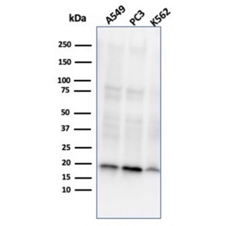 Western Blot - Anti-NME1 Antibody [NME1/2737] - BSA and Azide free (A278314) - Antibodies.com
