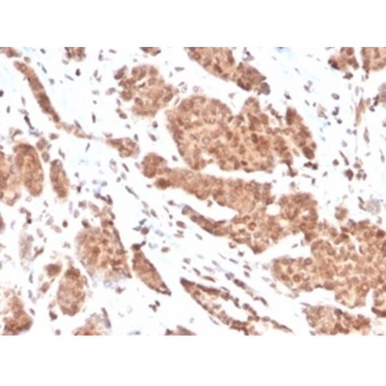 Immunohistochemistry - Anti-NME1 Antibody [NME1/2737] - BSA and Azide free (A278314) - Antibodies.com