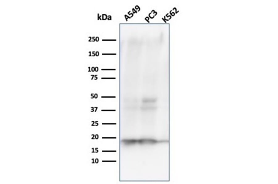Western Blot - Anti-NME1 Antibody [NME1/2738] - BSA and Azide free (A278315) - Antibodies.com