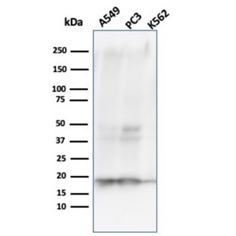 Western Blot - Anti-NME1 Antibody [NME1/2738] - BSA and Azide free (A278315) - Antibodies.com