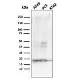 Western Blot - Anti-NME1 Antibody [NME1/2738] - BSA and Azide free (A278315) - Antibodies.com