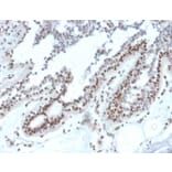 Immunohistochemistry - Anti-NME1 Antibody [NME1/2738] - BSA and Azide free (A278315) - Antibodies.com