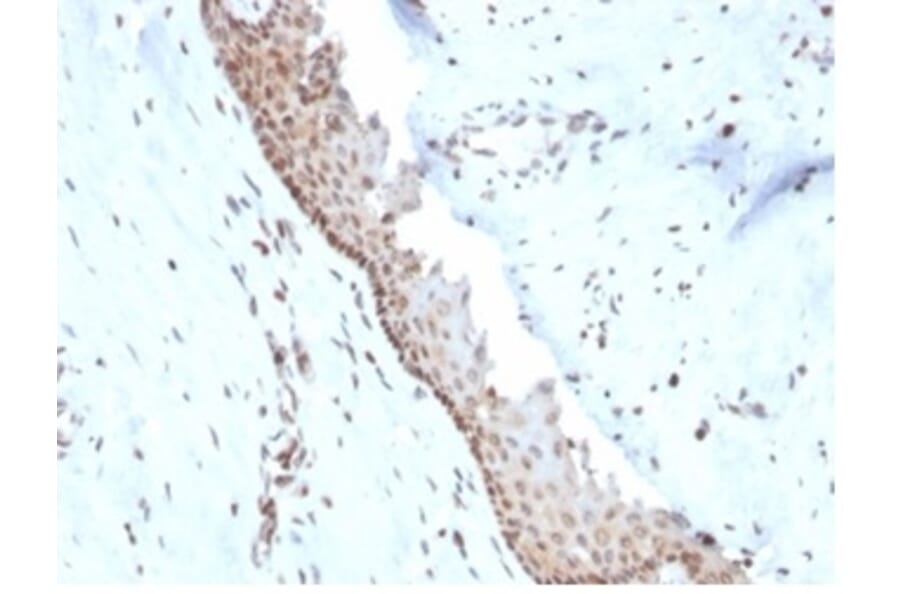 Immunohistochemistry - Anti-NME1 Antibody [NME1/2738] - BSA and Azide free (A278315) - Antibodies.com