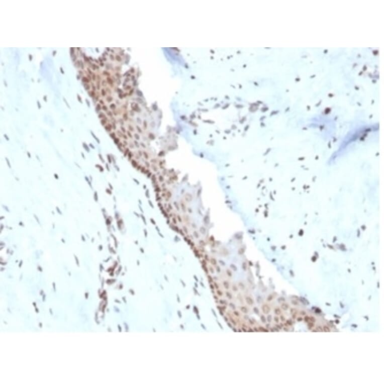 Immunohistochemistry - Anti-NME1 Antibody [NME1/2738] - BSA and Azide free (A278315) - Antibodies.com