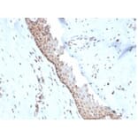 Immunohistochemistry - Anti-NME1 Antibody [NME1/2738] - BSA and Azide free (A278315) - Antibodies.com