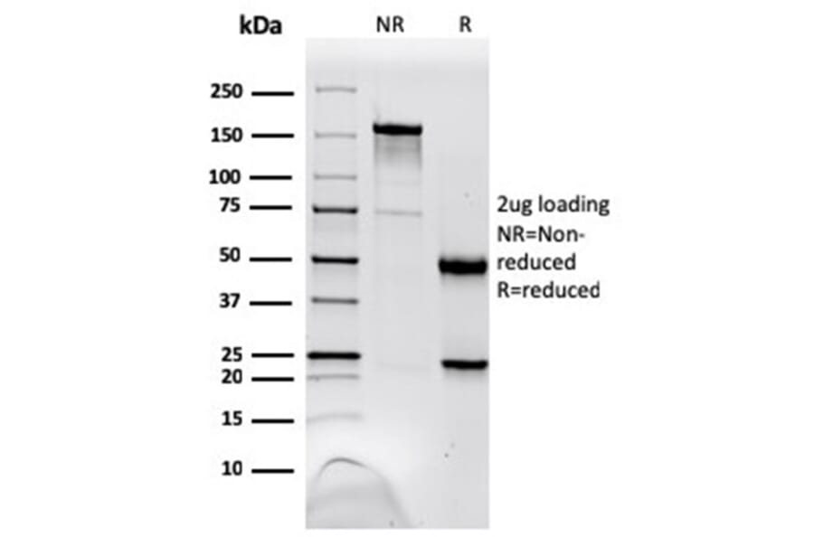 SDS-PAGE - Anti-NME1 Antibody [NME1/2738] - BSA and Azide free (A278315) - Antibodies.com