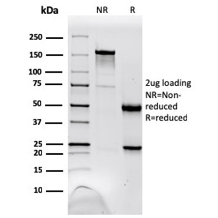 SDS-PAGE - Anti-NME1 Antibody [NME1/2738] - BSA and Azide free (A278315) - Antibodies.com