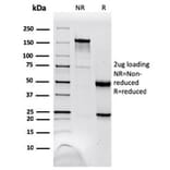 SDS-PAGE - Anti-NME1 Antibody [NME1/2738] - BSA and Azide free (A278315) - Antibodies.com