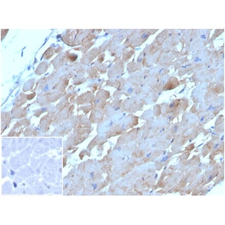 Immunohistochemistry - Anti-BNP Antibody [NPPB/4493] - BSA and Azide free (A278316) - Antibodies.com