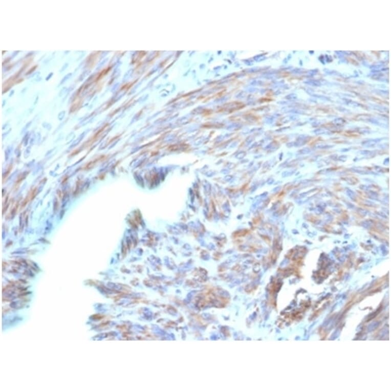 Immunohistochemistry - Anti-BNP Antibody [NPPB/4493] - BSA and Azide free (A278316) - Antibodies.com