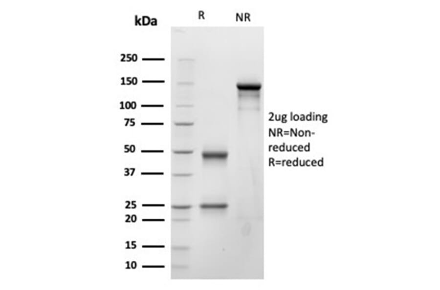 SDS-PAGE - Anti-BNP Antibody [NPPB/4493] - BSA and Azide free (A278316) - Antibodies.com