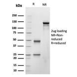 SDS-PAGE - Anti-BNP Antibody [NPPB/4493] - BSA and Azide free (A278316) - Antibodies.com