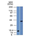 Western Blot - Anti-PAX2 Antibody [PAX2/1105] - BSA and Azide free (A278319) - Antibodies.com