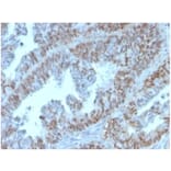 Immunohistochemistry - Anti-PAX2 Antibody [PAX2/1105] - BSA and Azide free (A278319) - Antibodies.com