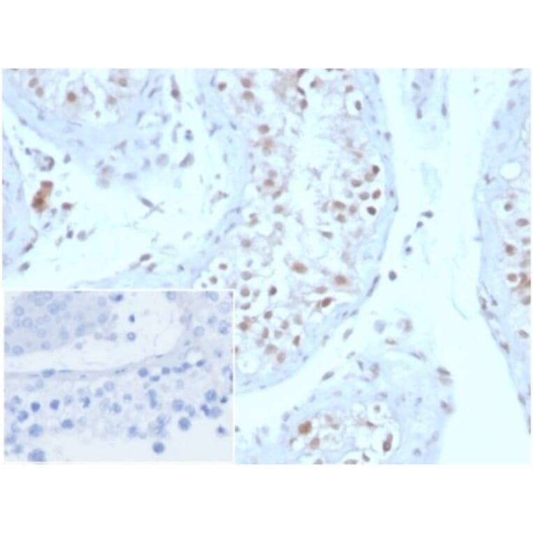 Immunohistochemistry - Anti-Geminin Antibody [GMNN/3665] - BSA and Azide free (A278322) - Antibodies.com