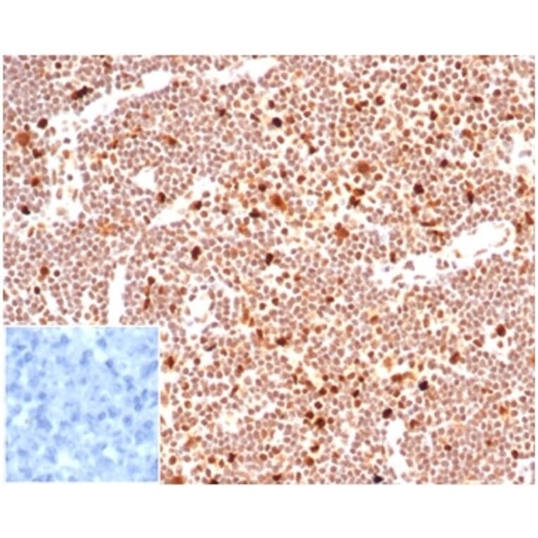 Immunohistochemistry - Anti-PCNA Antibody [PCNA/6580] - BSA and Azide free (A278324) - Antibodies.com
