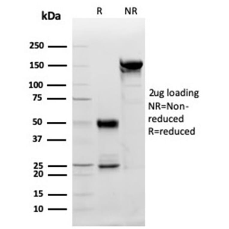 SDS-PAGE - Anti-PDGFB Antibody [PDGFB/3071] - BSA and Azide free (A278326) - Antibodies.com