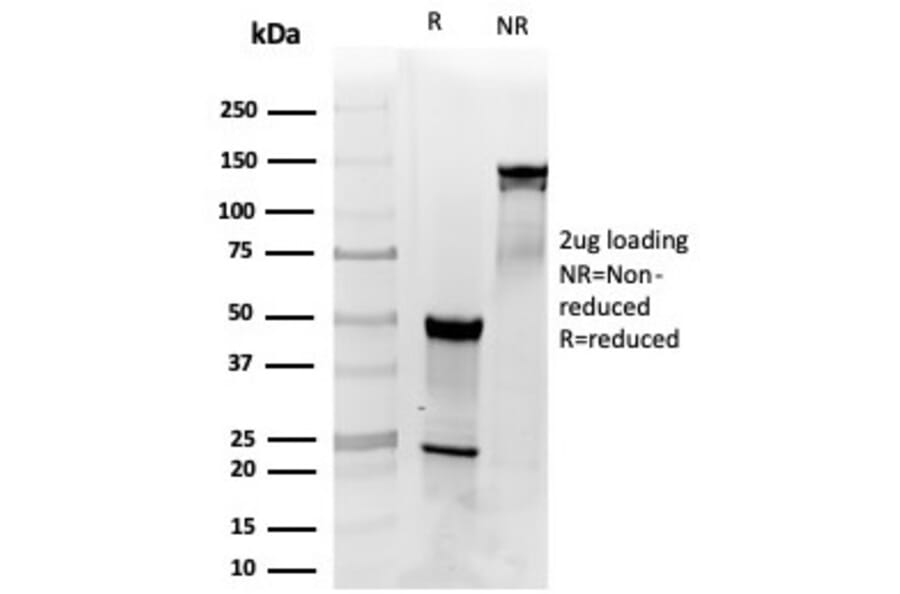 SDS-PAGE - Anti-PDGFB Antibody [PDGFB/3072] - BSA and Azide free (A278327) - Antibodies.com