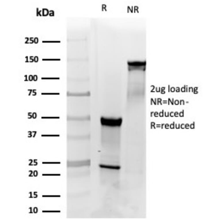 SDS-PAGE - Anti-PDGFB Antibody [PDGFB/3072] - BSA and Azide free (A278327) - Antibodies.com