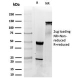 SDS-PAGE - Anti-PDGFB Antibody [PDGFB/3072] - BSA and Azide free (A278327) - Antibodies.com