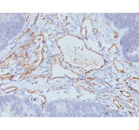 Immunohistochemistry - Anti-CD31 Antibody [C31.3 + JC/70A] - BSA and Azide free (A278329) - Antibodies.com