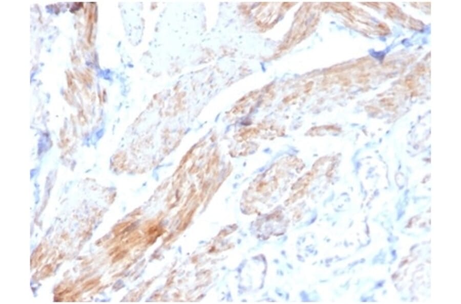 Immunohistochemistry - Anti-Phosphoglucomutase 5 Antibody [PGM5/3552] - BSA and Azide free (A278330) - Antibodies.com