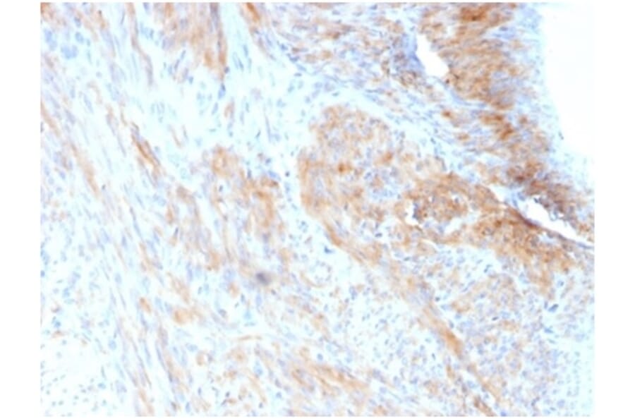 Immunohistochemistry - Anti-Phosphoglucomutase 5 Antibody [PGM5/3552] - BSA and Azide free (A278330) - Antibodies.com