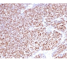Immunohistochemistry - Anti-Progesterone Receptor Antibody [PGR/3817] - BSA and Azide free (A278331) - Antibodies.com