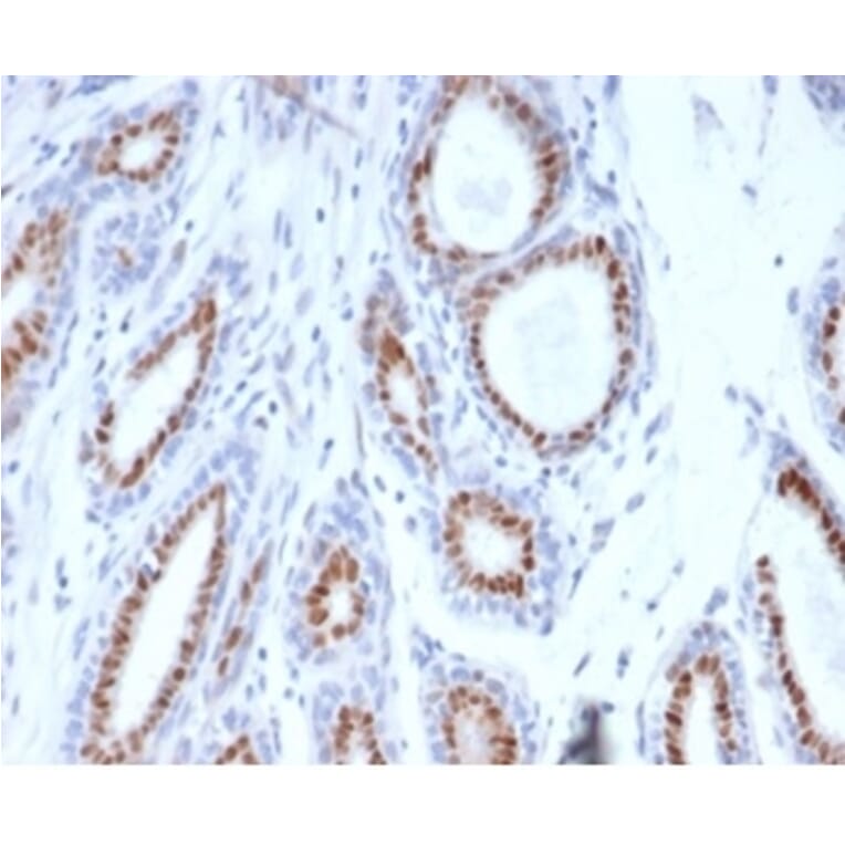 Immunohistochemistry - Anti-Progesterone Receptor Antibody [PGR/3817] - BSA and Azide free (A278331) - Antibodies.com