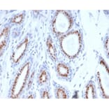 Immunohistochemistry - Anti-Progesterone Receptor Antibody [PGR/3817] - BSA and Azide free (A278331) - Antibodies.com