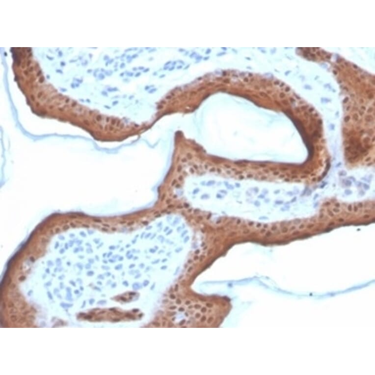 Immunohistochemistry - Anti-Maspin Antibody [SERPINB5/4972] - BSA and Azide free (A278332) - Antibodies.com