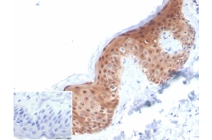 Immunohistochemistry - Anti-Maspin Antibody [SERPINB5/4972] - BSA and Azide free (A278332) - Antibodies.com
