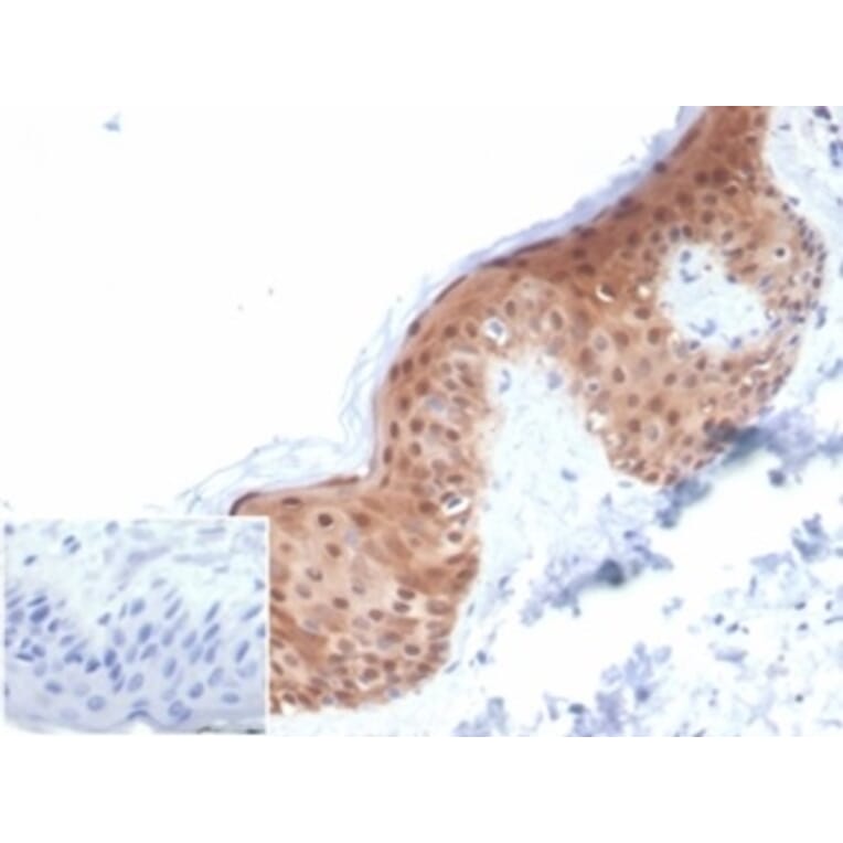 Immunohistochemistry - Anti-Maspin Antibody [SERPINB5/4972] - BSA and Azide free (A278332) - Antibodies.com
