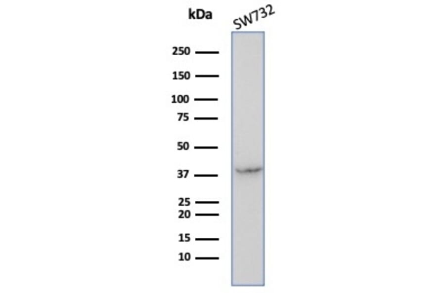 Western Blot - Anti-Maspin Antibody [SERPINB5/4972] - BSA and Azide free (A278332) - Antibodies.com