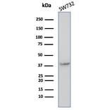 Western Blot - Anti-Maspin Antibody [SERPINB5/4972] - BSA and Azide free (A278332) - Antibodies.com