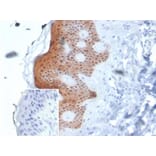 Immunohistochemistry - Anti-Maspin Antibody [SERPINB5/4975] - BSA and Azide free (A278333) - Antibodies.com