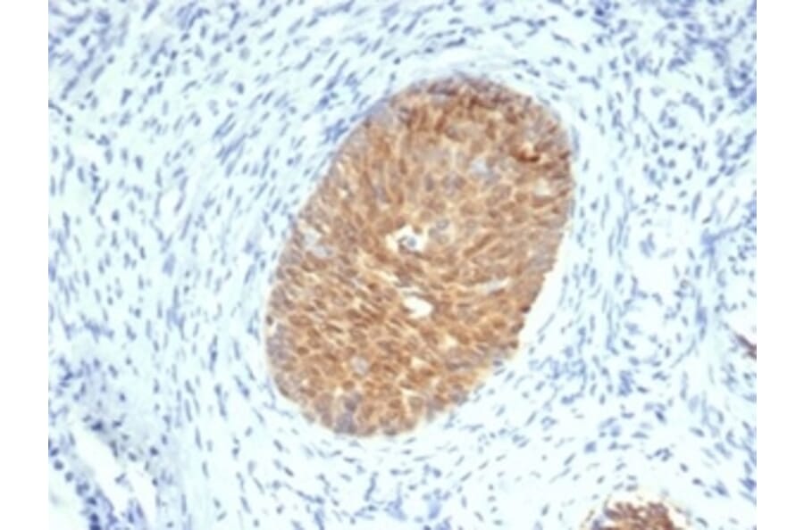Immunohistochemistry - Anti-Maspin Antibody [SERPINB5/4975] - BSA and Azide free (A278333) - Antibodies.com